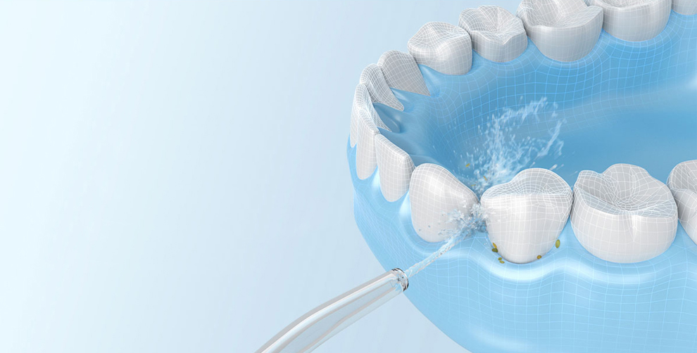 Беспроводной ирригатор для полости рта Xiaomi Mijia Electric Flusher (MEO701)